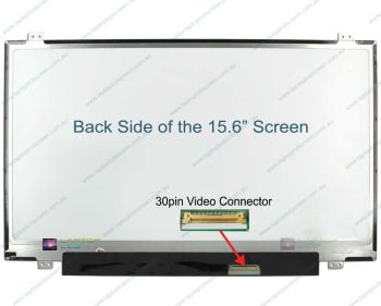 LG LP156WFC(SP)(R1) Replacement Laptop LCD Screen Panel (IPS)